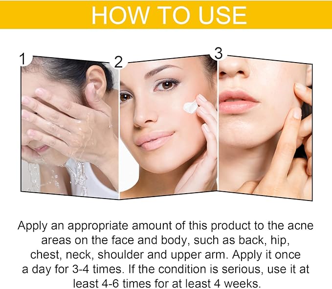 Acne Cleaning Cream